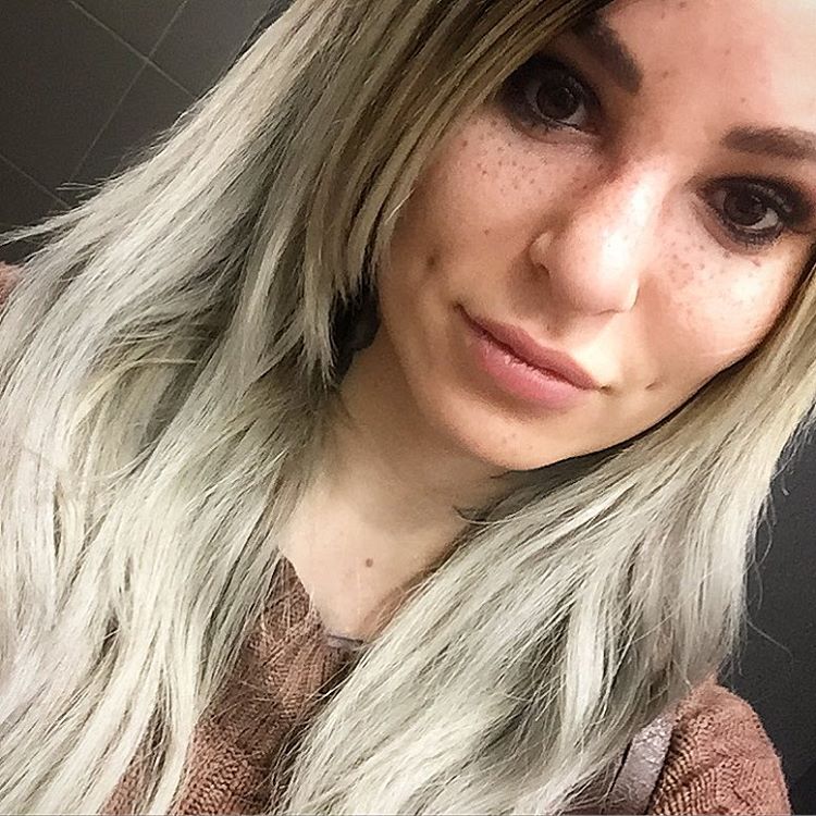 freckle-sydney-self-healed